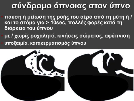 ΤΡΑΚΑΔΑ ΥΠΝΟΣ_Page_21